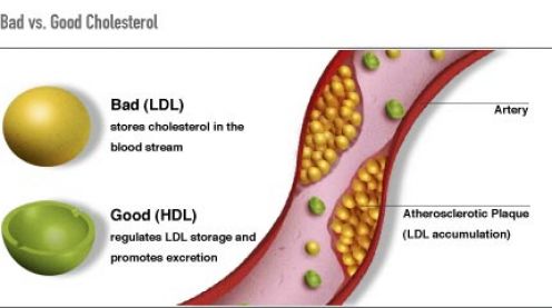 good-and-bad-cholesterol